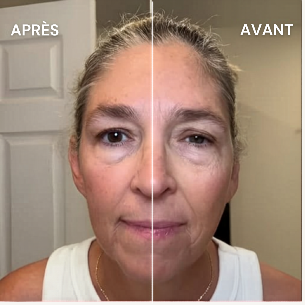 Drena™️  - Brosse lymphatique faciale